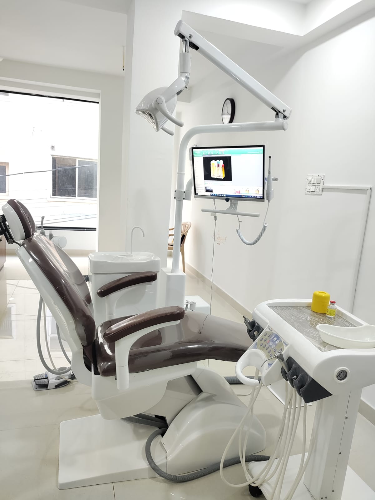 Advanced Equipment
